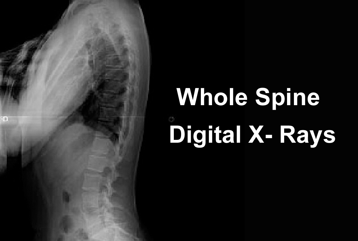Special Whole Spine Digital X- Rays