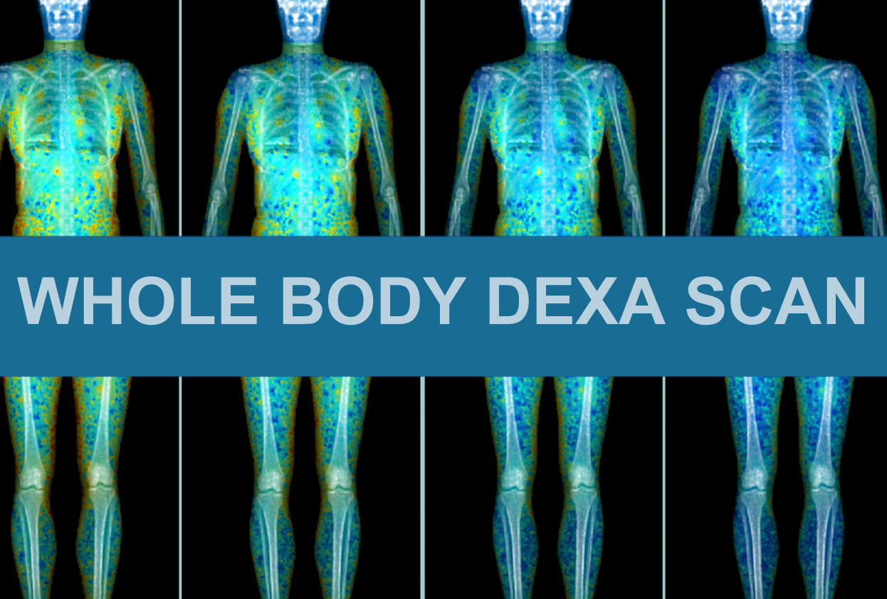 Whole Body Dexa Scan