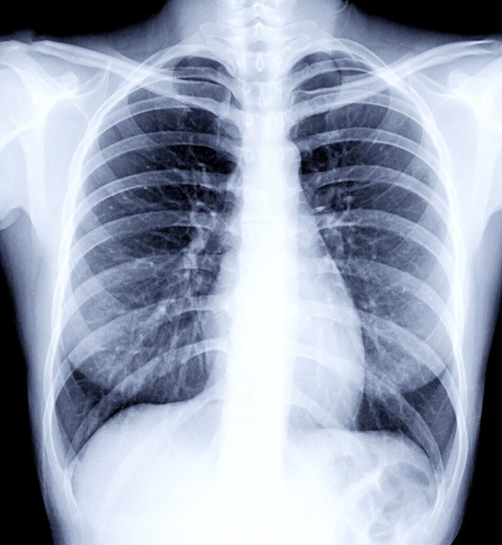 BEST X RAY SERVICES
